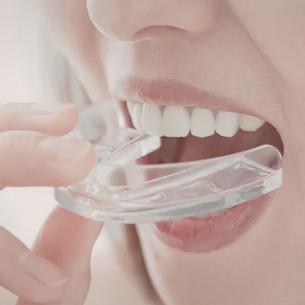 Şeffaf Plak (Aligner) Tedavileri